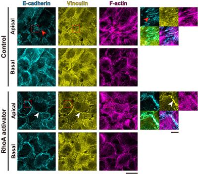 Anti-Malignant Effect of Tensile Loading to Adherens Junctions in Cutaneous Squamous Cell Carcinoma Cells